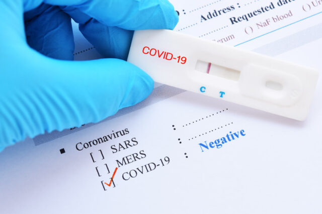 新型コロナウイルス 迅速PCR検査